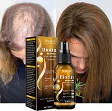 Biotin Hair Growth Spray Anti Hair Loss Fast Regrowth Scalp Treatment Serum
