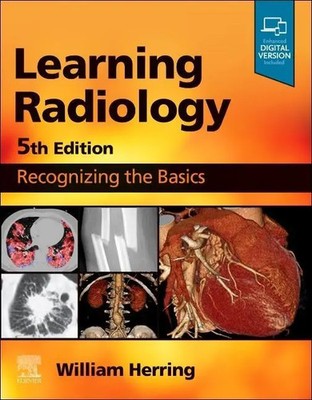 William Herring | Learning Radiology | Taschenbuch | Englisch (2023)