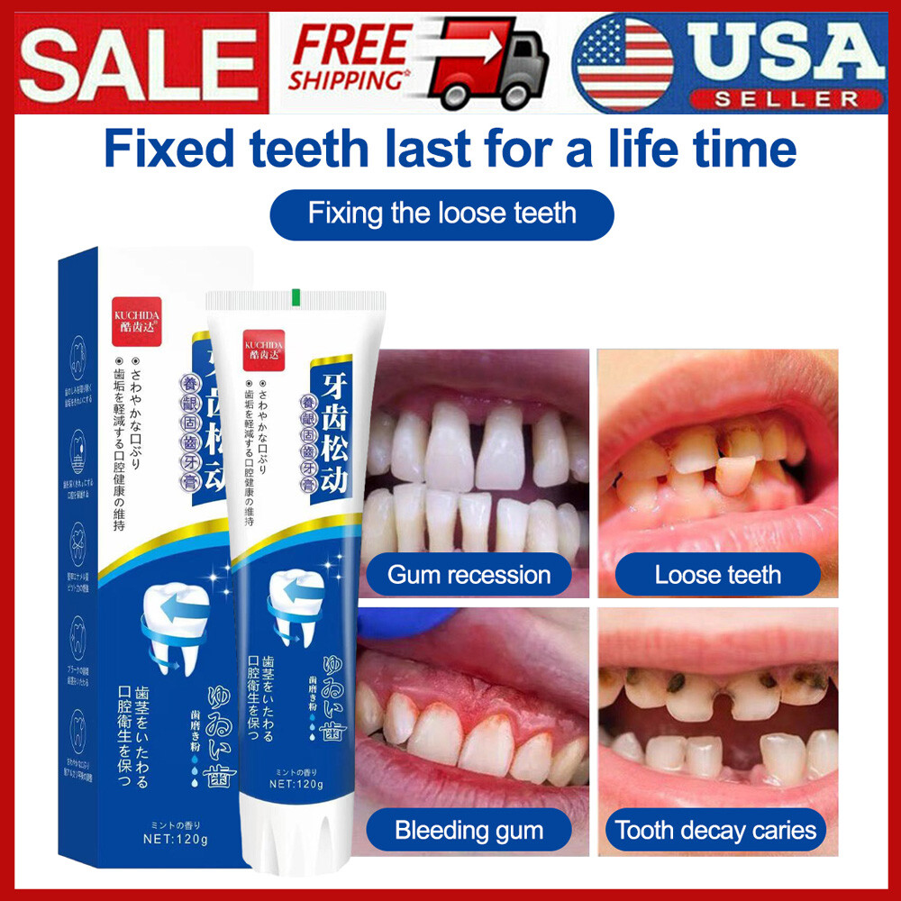 Loose Teeth Care Toothpaste Gingivitis Treatment & Cavity Repair Toothpaste US