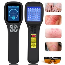 308nm Phototherapy UVB Light Lamp Device for Skin Diseases Treatment 49 Diodes