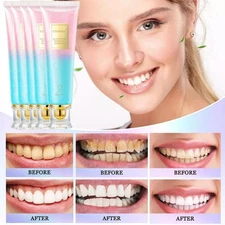Niacinamide Whitening Toothpaste,Natural Niacinamide Toothpaste,Teeth Whitening