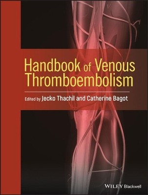 Handbook of Venous Thromboembolism by Jecko Thachil (English) Hardcover Book