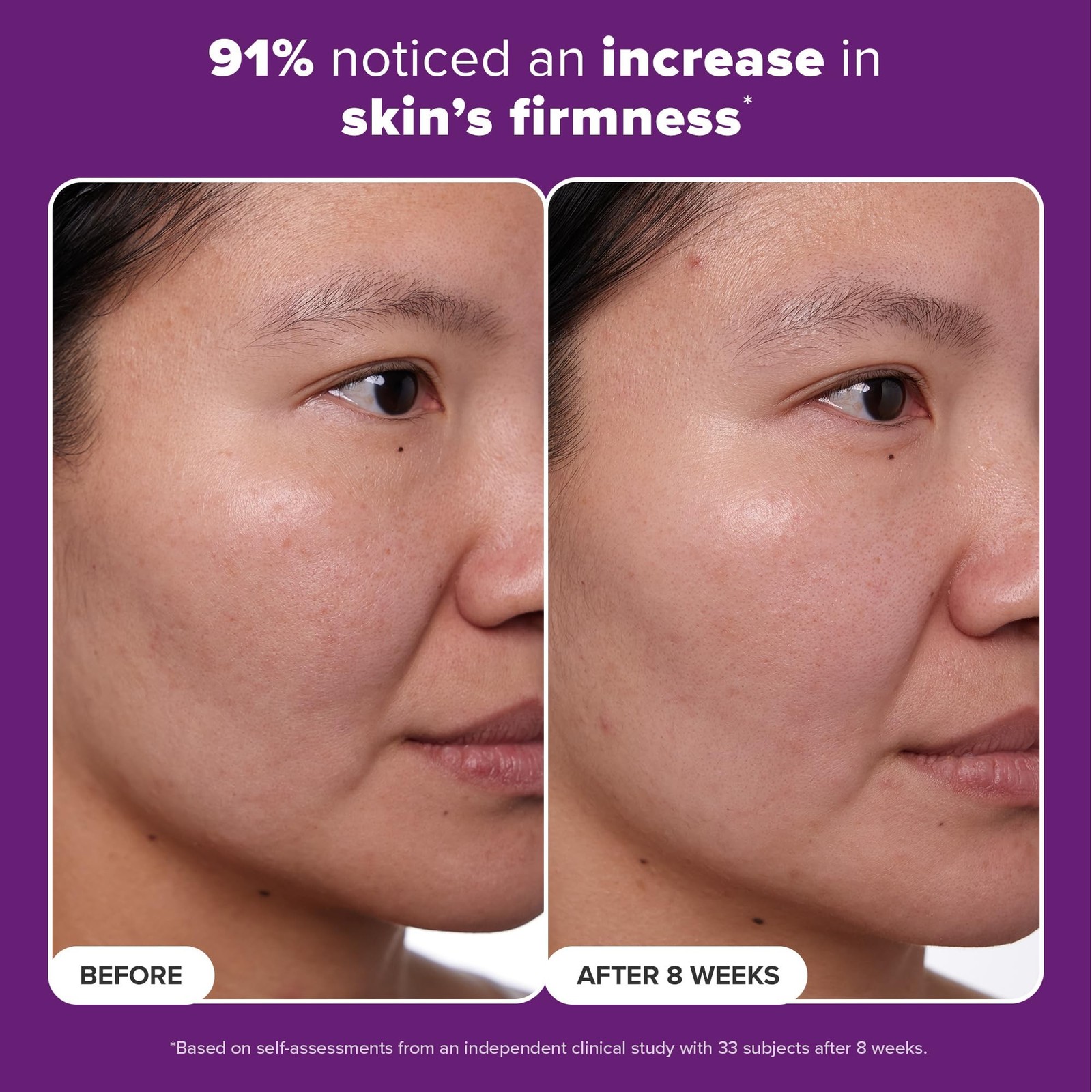 Paula's Choice CLINICAL 1% Retinol Face Moisturizer Treatment with Peptides, ...