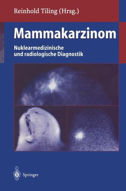 Thumbnail - Mammakarzinom | Nuklearmedizinische Und Radiologische Diagnostik |