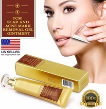 TCM and Scar Acne Marks Removal Cream Skin Burns Cuts Stretch Mark Treatment Gel