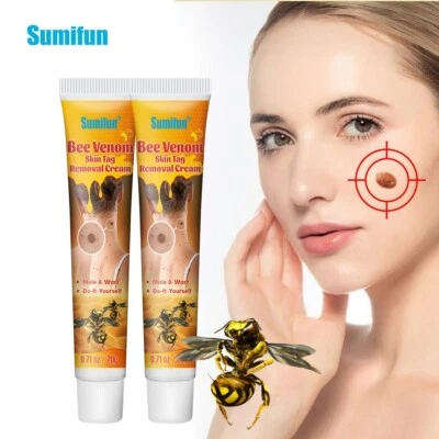 SUMIFUN New 20g Warts Remover Ointment Skin Tag Treatment Remove Mole & Wart Cream