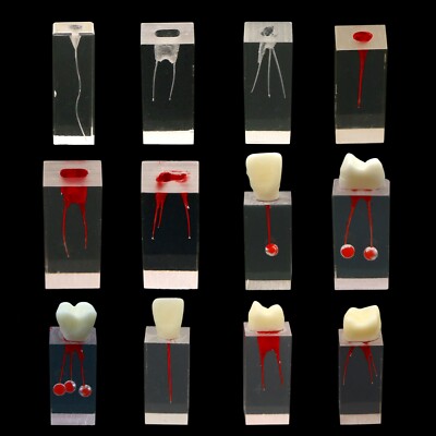 10Pcs Dental Endo Root Canals Teeth Model Practice Block RCT Pulp Cavity Study