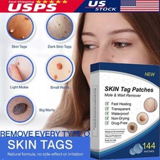 720pc Skin Tag Remover Patches Quick Effective Mole and Wart Pad Removal Sticker