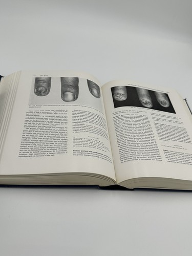TEXTBOOK OF DERMATOLOGY By Arthur D. S. Wilkinson And F. J. G. Ebling Rook 1 & 2 - Picture 14 of 16