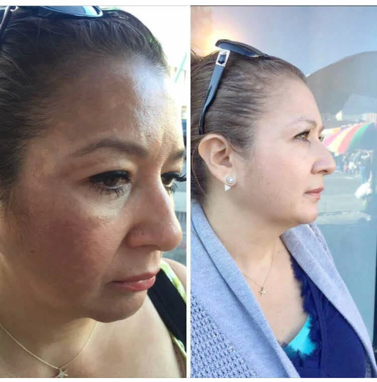 SKIN LIGHTENING TREATMENT:TRATAMIENTO EFECTIVO PARA BORRAR MANCHAS OSCURAS 2oz. - Image 3 of 4