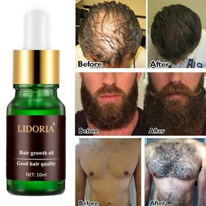 30ml Men Women Hair Growth Essential Ginger Oil Hair Loss Baldness