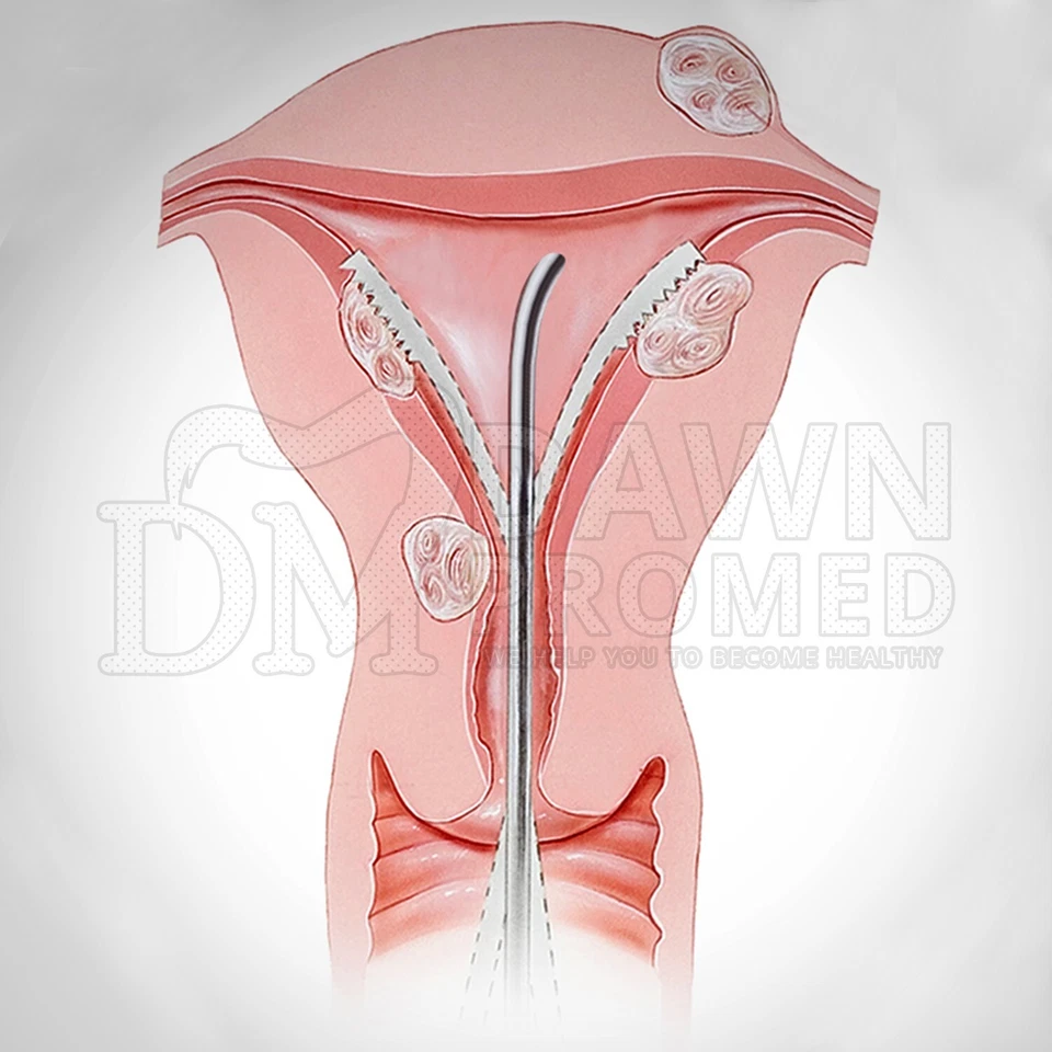 6 Pcs Sims Uterine Sounds Malleable Curved 13” Set OB/GYN Surgical Inst German G - Image 4 of 4