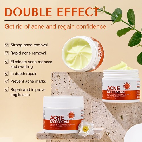 Acne Cream Salicylic Acid Cystic Acne Treatment For Face Back Butt Acne Treat... - Picture 5 of 7