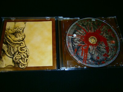 GENERAL SURGERY - Left Hand Pathology. CD | eBay