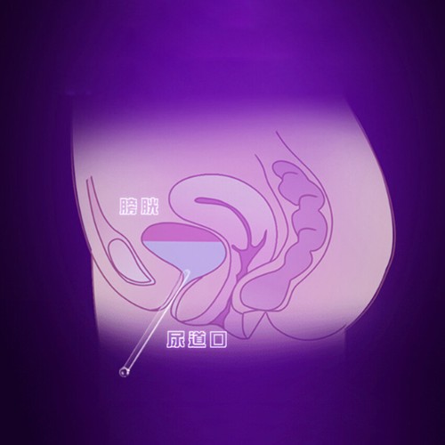 8 Piezas-Uretra-Sonido-Macho-Pene Enchufe Largo Vidrio Uretra Dilatador Catéter - Imagen 6 de 12