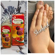 clear all dark knuckles clear  dark spot remover oil  Carrot,Papaya,Turmeric