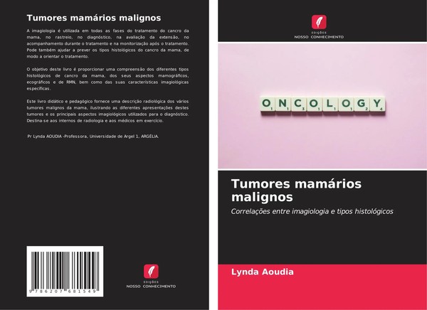 Lynda Aoudia | Tumores MamáRios Malignos | Taschenbuch | Portugiesisch (2024)-image