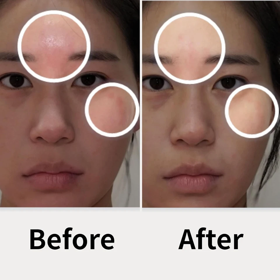 All-Age Solution for Itchy Skin - Cica Liposome Technology - Image 4 of 4