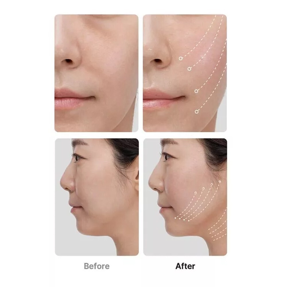 ウルトラチューン◎MEDICUBE AGE-R ULTRA TUNE 40.68 Medicube AGE-R Ultra Tune 40.68 Anti-Ageing Lifting Device