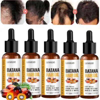 5/3x Batana Oil Essence For Hair Growth Anti-Hair Loss Damaged Hair Roots Repair