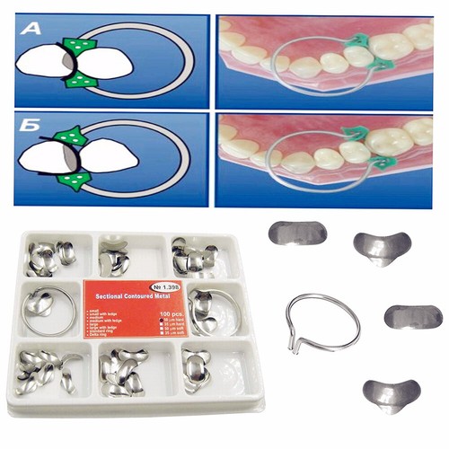 100pcs Dental Sectional Contoured Matrices Matrix Ring & 40 Add-On Wedges Kit - Picture 10 of 15