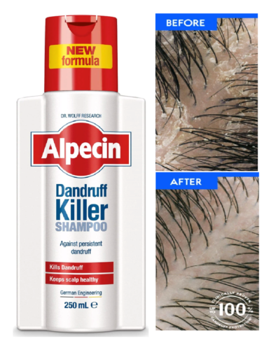 Alpecin Anti-Dandruff Shampoo For Men & Women | Dandruff Killer 250ml - Afbeelding 1 van 8