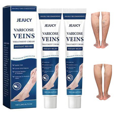 Varicose Veins Treatment for Legs,2 Pack Varicose Veins Cream Body Cream for Spi