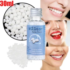Temporary Tooth Repair Kit Temp Dental Repair Granules Replace Missing DIY Make