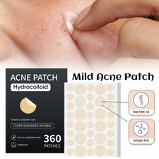 Mild Acne Patch Invisible Acne Removal Skin Care Stickers Makeup Tools 360PCS
