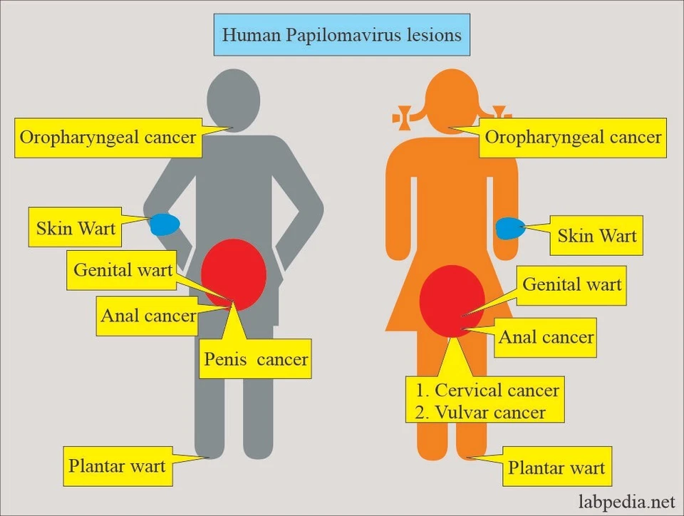 TERAPIA DE HIERBAS NATURALES PARA BACTERIAS STI MUJERES Y HOMBRES - 120 CÁPSULAS - HECHO EN EE. UU. Foto 3 de 4
