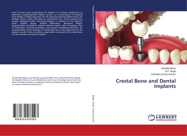 Nivedita Bawa (U. A.) | Crestal Bone And Dental Implants | Taschenbuch (2018)-image