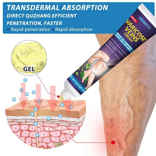 5 Boxes Varicose Veins Cream Varicose Vein Treatment Herb Ointment Leg Pain Balm - Picture 3 of 9