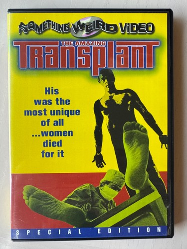 The Amazing Transplant (1970) - 2001 Something Weird Video Image MOD DVD-R