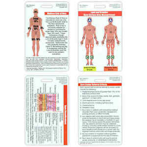 Ems Burn Chart