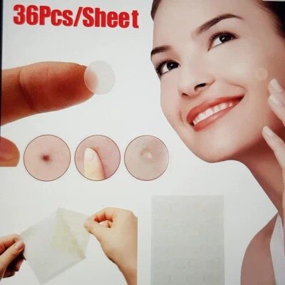 Patch Bouton, Anti-Acné, SOS spot, Hydrocololloid, Dissimule L’acné, 36Pcs, Fran - Photo 1/4