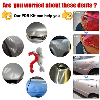Produktbild von FOLANDO 4 Stück Saugheber Dellen Reparaturset Auto Beulenzieher Beulen Reparaturset Auto Dellen