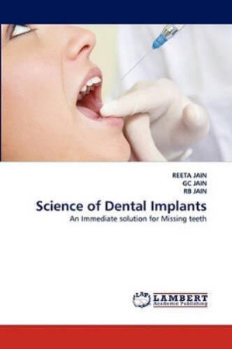 Reeta Jain Gc Jain Rb Jain Science of Dental Implants (Paperback) - Bild 1 von 1