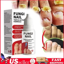 Fungi-Nail Anti-Fungal Liquid Solution Kills Fungus That Can Lead To Nail