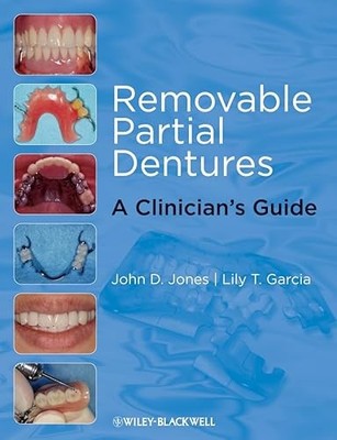 Removable Partial Dentures: A Clinician's Guide by John D. Jones NEW