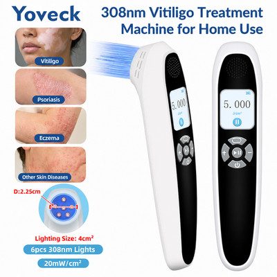 308nm UVB Phototherapy Blue Light Device 6 Diodes for Skin Disorders LCD Screen