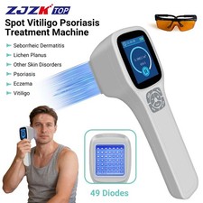 308nm Narrowband UVB Blue Light Device Rechargeable LCD for Skin Care Areas
