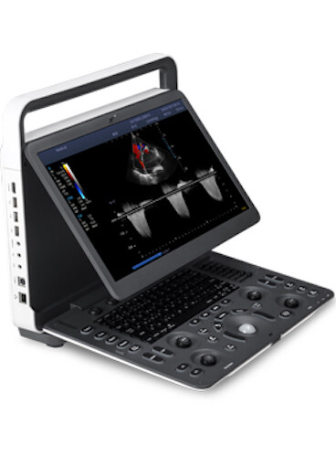 SonoScape E2 ultrasound & One linear array probe L741 Color doppler Vascular