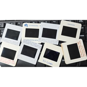 Vintage 1978 Ophthalmology Medical Slides Donald Keller Eye Surgery Anatomy 8pc