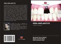 Navneet Kour Mehta (U. A.) | PÉRI-IMPLANTITE | Taschenbuch | FranzöSisch (2021)