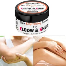 New Strong Whitening Cream For Removing Dark Knuckle Finger Elbow and Knee