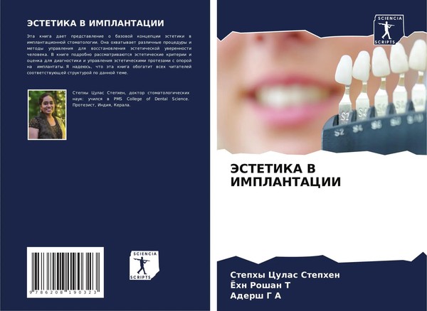 Jestetika V Implantacii Stephy Culas Stephen (U. A.) Taschenbuch Russisch 2024-image