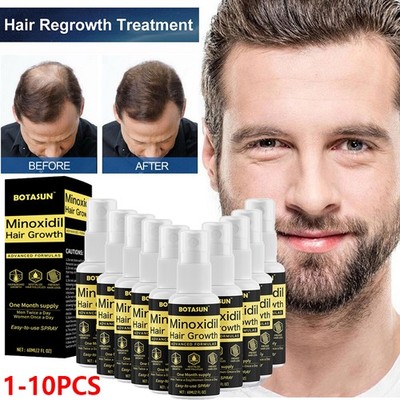 Minoxidil 5% Hair Regrowth Treatment Topical Solution for Men 1-10 Month Supply