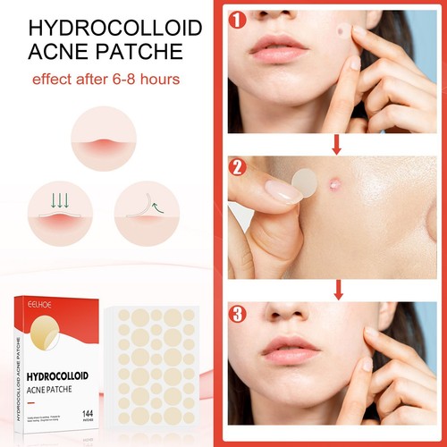 Tag Remover Patch Acne Spot Treatment Ance Pimple Patches Hydrocolloid Master - Picture 5 of 6