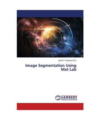 Image Segmentation Using Mat Lab
