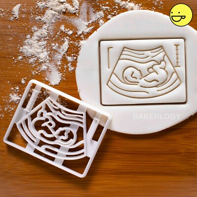 Schwangerschaft Ultraschall Scan Keksausstecher | Ankündigung Geburt Baby Party schwanger